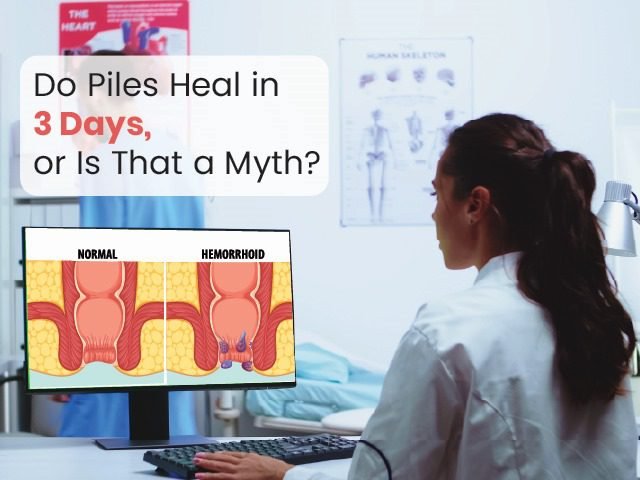Do Piles Heal in Three Days, or Is That a Myth?