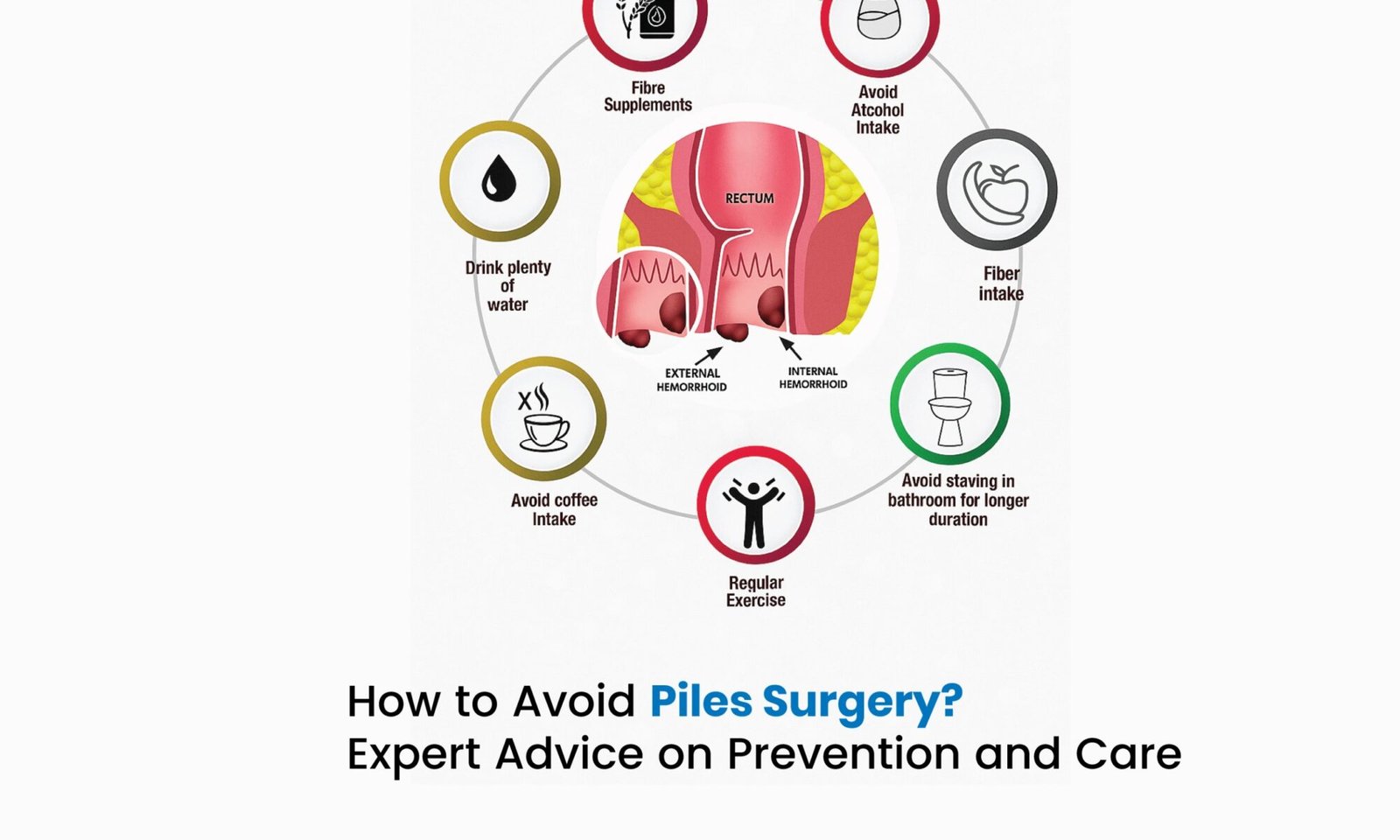How to Avoid Piles Surgery?