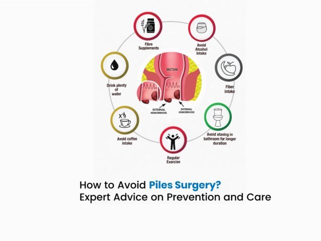 How to Avoid Piles Surgery? Expert Advice on Prevention and Care