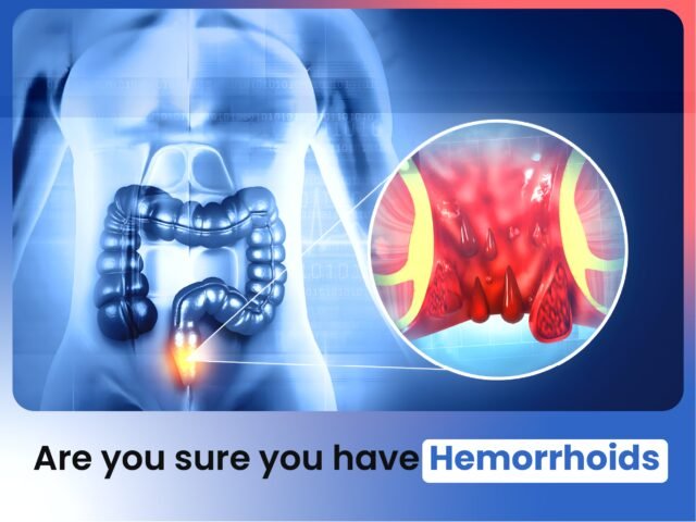Are you sure you have Hemorrhoids