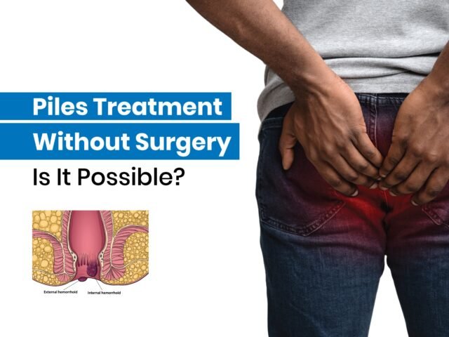 Piles Treatment Without Surgery – Is It Possible?