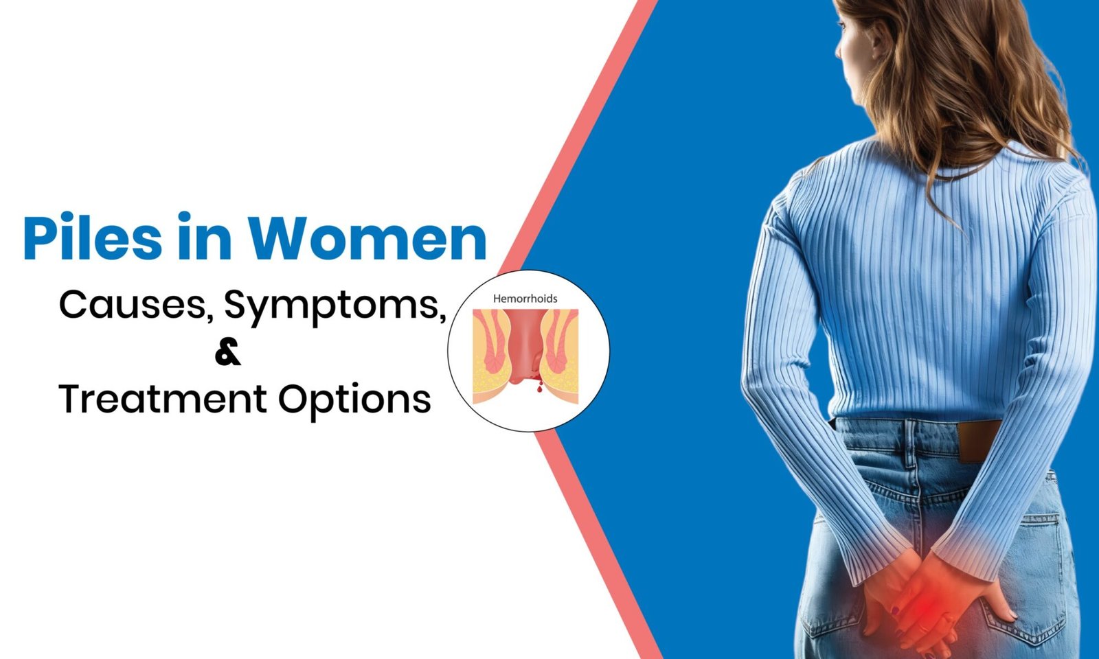 Piles Treatment for Women in Hyderabad