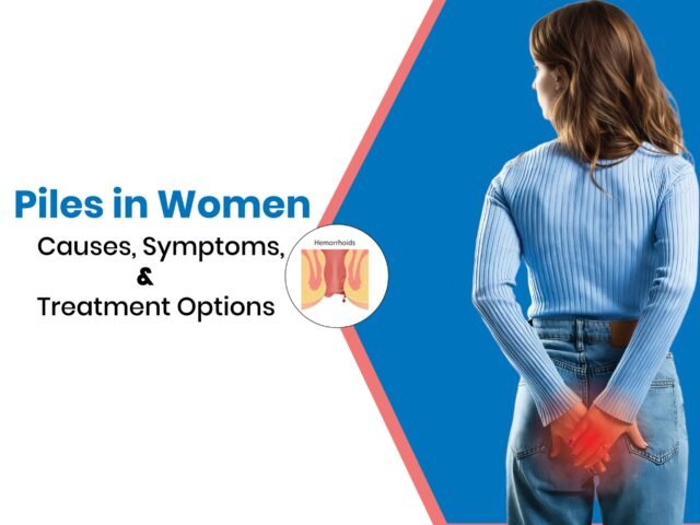 Piles in Women – Causes, Symptoms, and Treatment Options
