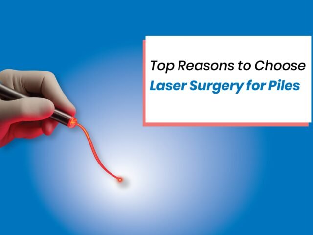 Top Reasons to Choose Laser Surgery for Piles