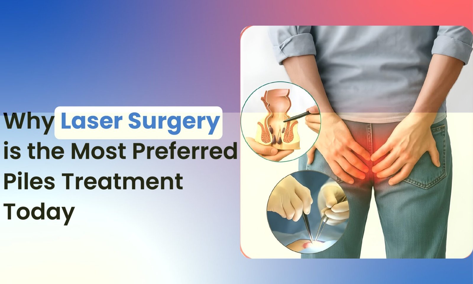 Laser Surgery is the Most Preferred Piles Treatment