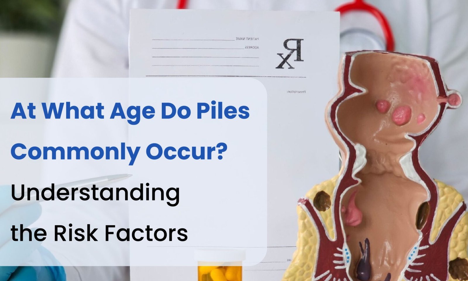 At What Age Do Piles Commonly Occur