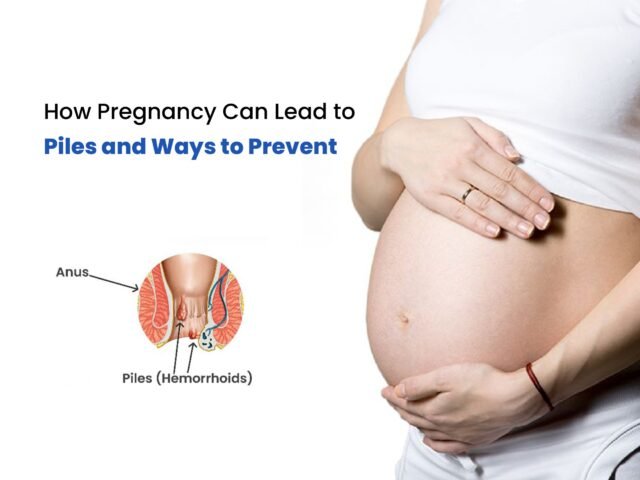 How Pregnancy Can Lead to Piles and Ways to Prevent It