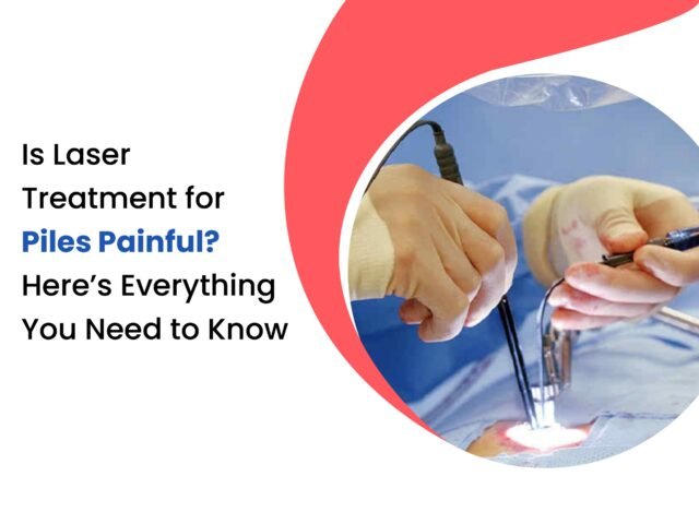Is Laser Treatment for Piles Painful? Here’s Everything You Need to Know