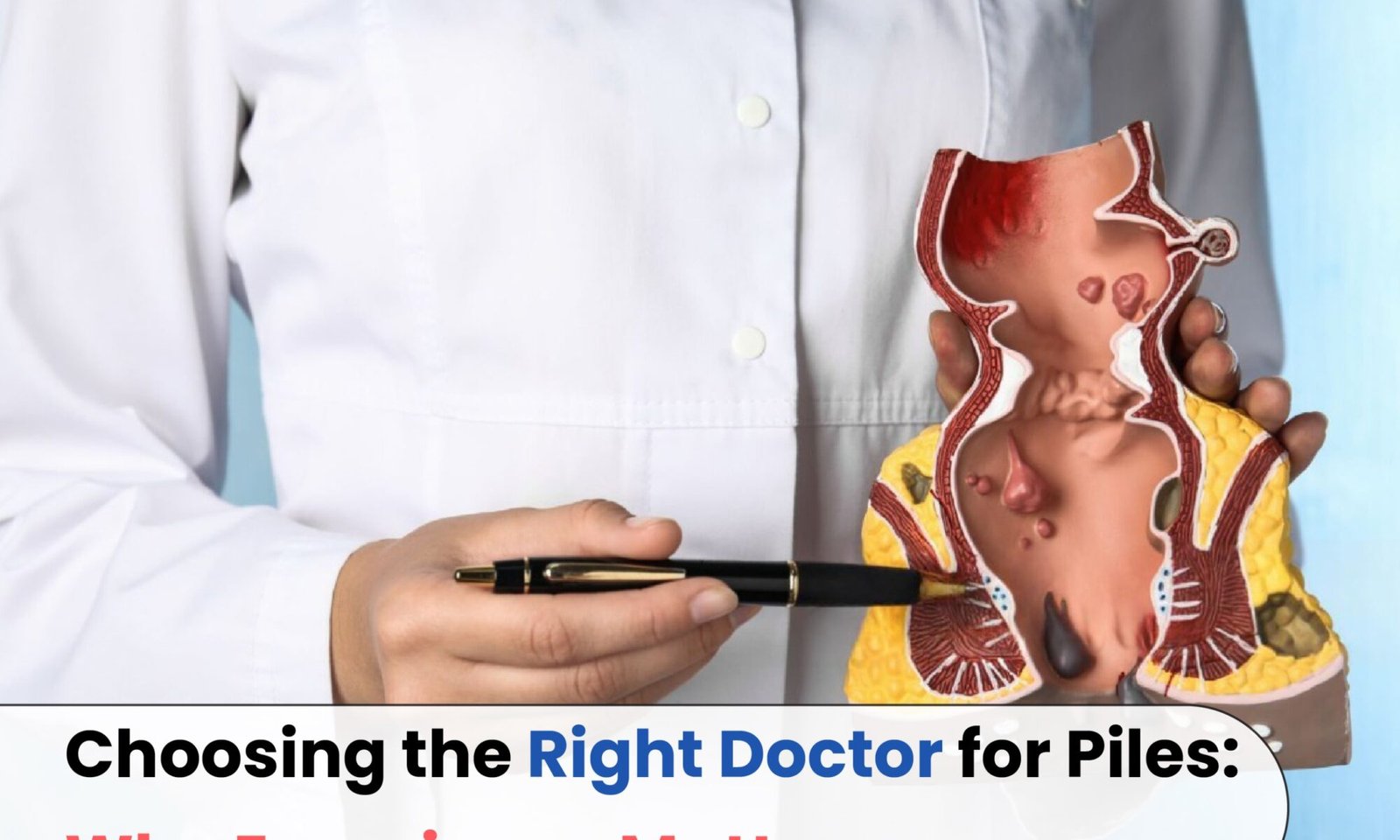 Choosing the Right Doctor for Piles