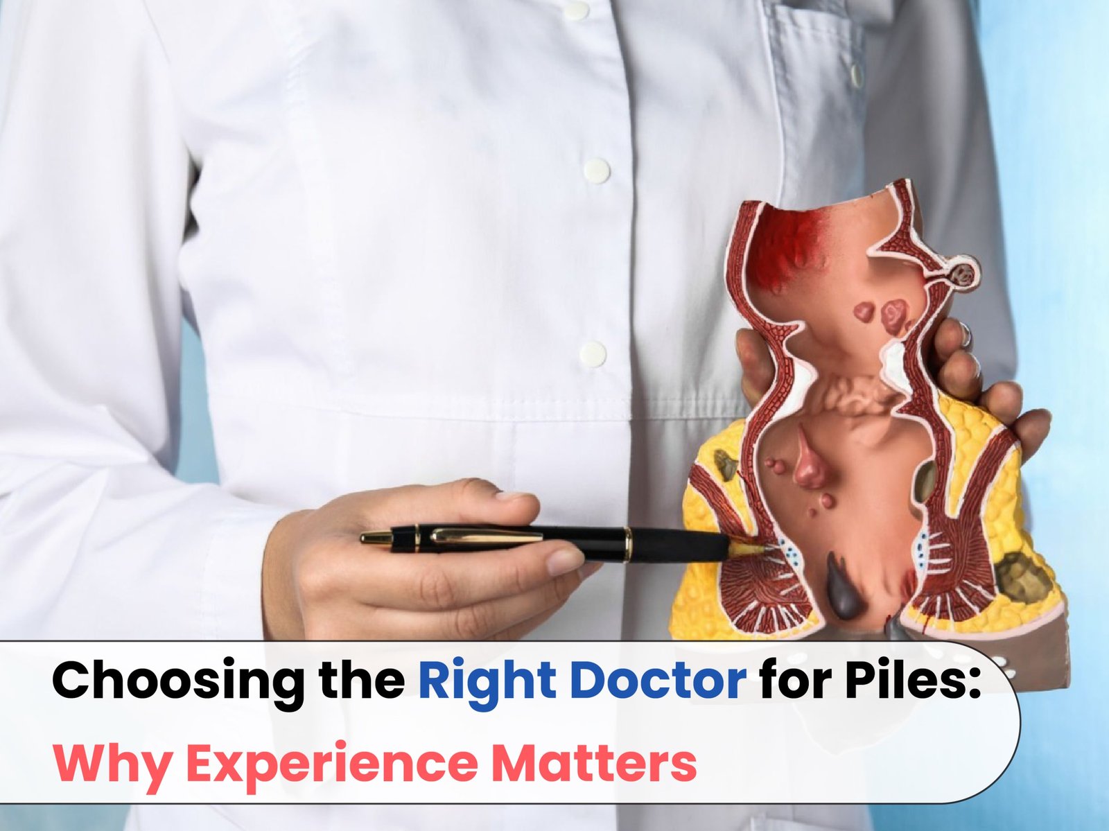Choosing the Right Doctor for Piles