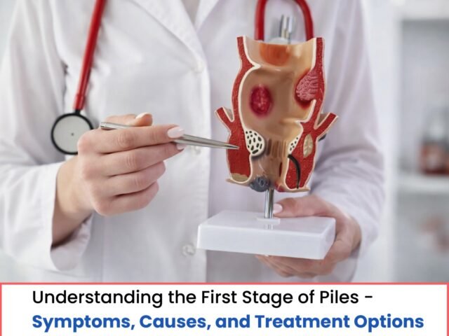 Understanding the First Stage of Piles – Symptoms, Causes, and Treatment Options