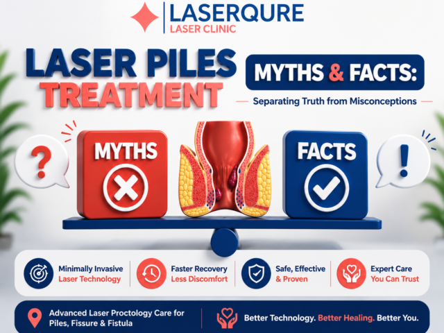 Laser Piles Treatment Myths & Facts: Separating Truth from Misconceptions
